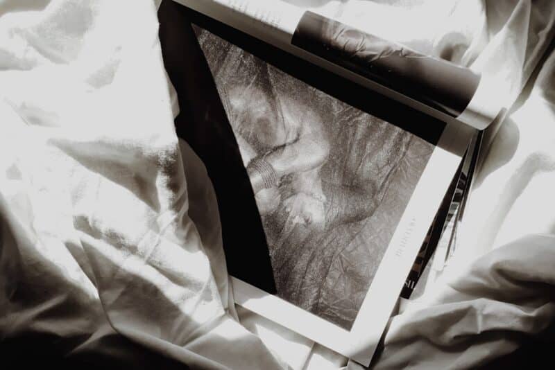 Bring Old Photos Back to Life